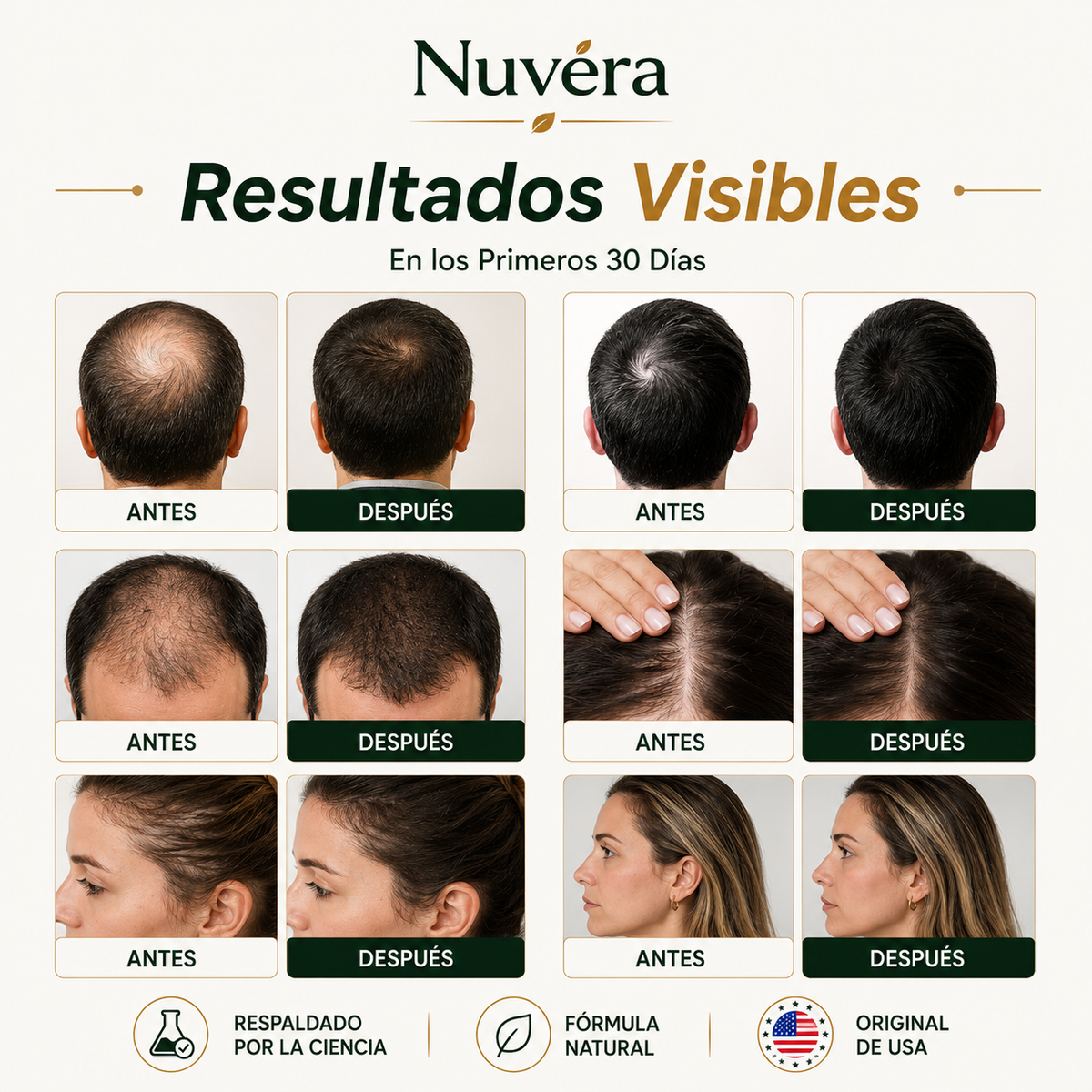 ACEITE NUVERA® DE BATANA PARA EL CRECIMIENTO CAPILAR